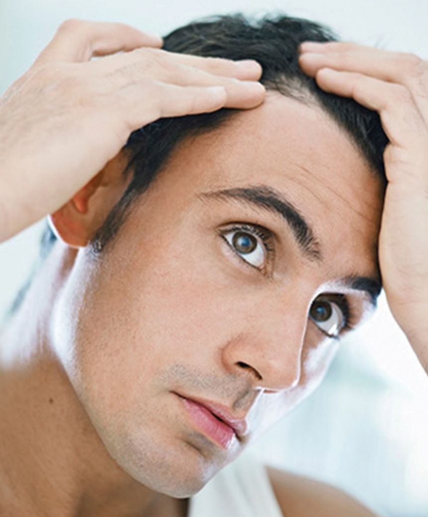 Price of Hair Transplant Price of Hair Transplant