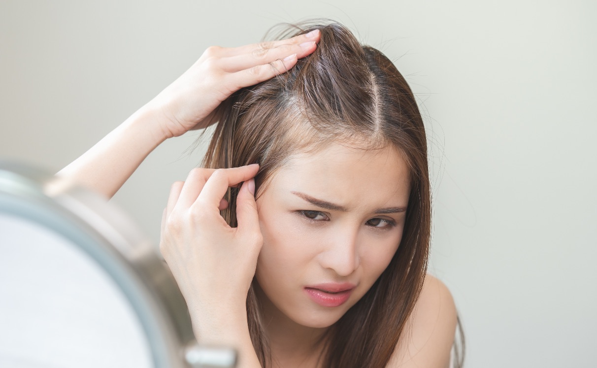 Eflúvio Telógeno vs Alopecia Androgenética: como entender a queda de cabelo