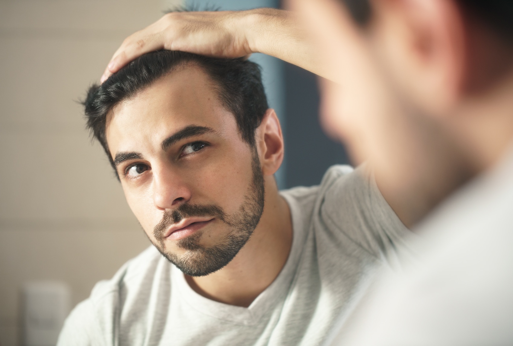 O que causa a Calvície Masculina? O que causa a Calvície Masculina?
